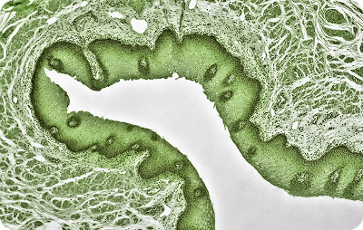 Innovative treatments